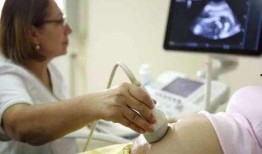 娱乐圈b超单子爆料