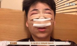 整容网红爆料视频大全,独家爆料视频大全