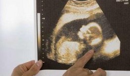 娱乐圈b超单子爆料